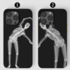 Çift Sevgili İskeletler Tasarımlı Baskılı Telefon Kılıfı